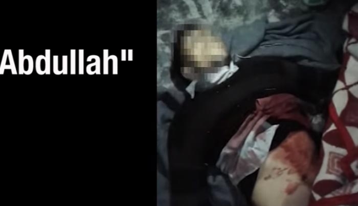 Καταγγελία- σοκ: Τούρκοι συνοριοφύλακες δολοφονούν και βασανίζουν πρόσφυγες (ΣΚΛΗΡΕΣ ΕΙΚΟΝΕΣ)