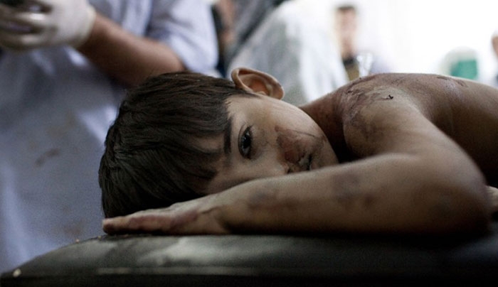 Νεκρά παιδιά από φωτιά σε κλινική στη Συρία – 25 νεκροί, 30 τραυματίες