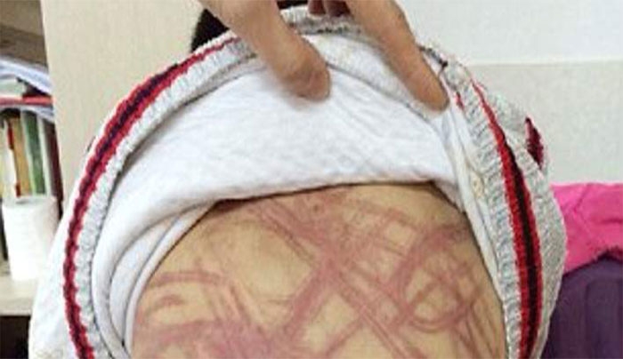 Βασανιστήρια στην Κίνα: Μαστίγωσε τον θετό της γιο γιατί δεν ήξερε το παραμύθι του Πινόκιο (Photos)