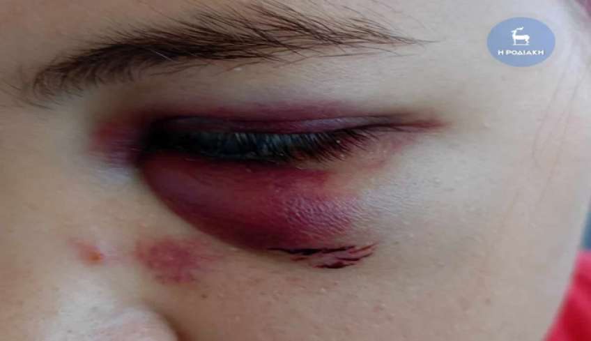 Σοκαριστική βία μεταξύ ανήλικων κοριτσιών στη Ρόδο: Δεν πίστευαν τα μάτια τους οι εκπαιδευτικοί (βίντεο)