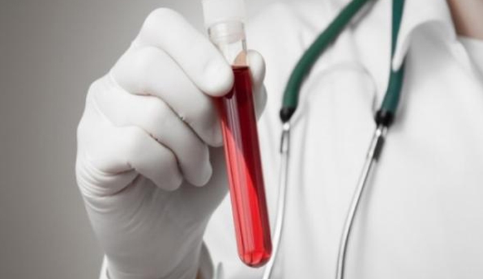 Χαμηλός αιματοκρίτης: Πώς θα τον ενισχύσετε