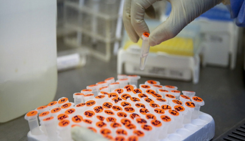Μόσιαλος: 254 κλινικές δοκιμές εξετάζουν θεραπείες ή εμβόλια για τον κορωνοϊό -Πότε αναμένονται αποτελέσματα