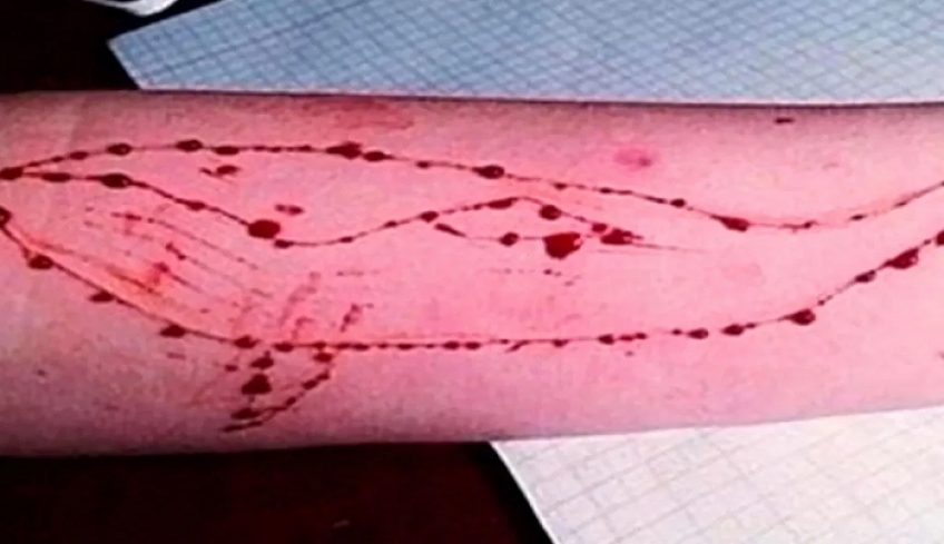 Αυτοκτονία 15χρονου- Ερευνούν αν ο θάνατός του προκλήθηκε από τη “Μπλε Φάλαινα”