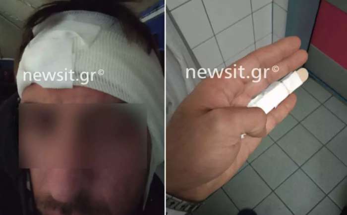 «Δάγκωσε το αυτί μου και έκοψε κομμάτι με τα δόντια του» – Τι περιγράφει στο newsit.gr ο διανομέας από την Πέλλα