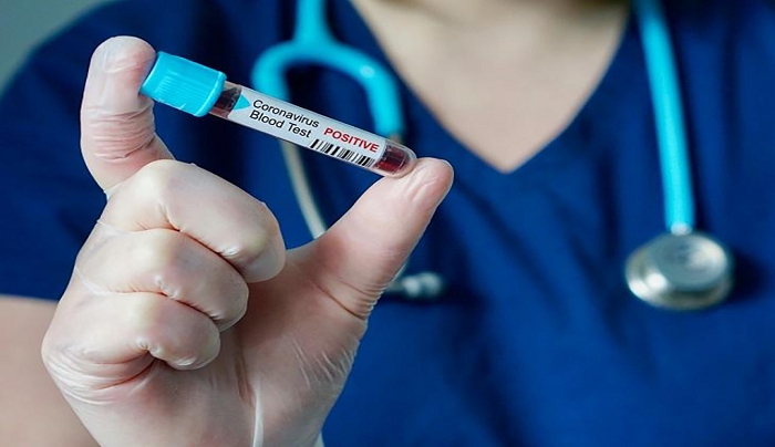 11 νέα κρούσματα, τα 5 εισαγόμενα-Ενα στην περιφερειακή ενότητα Καρπάθου