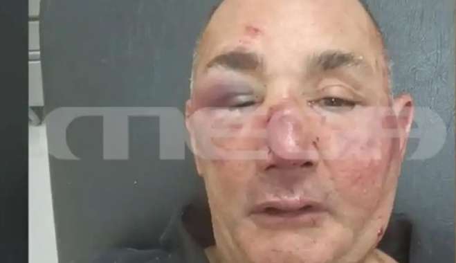 Ο χρυσοχόος που δέχθηκε επίθεση στην Ρόδο