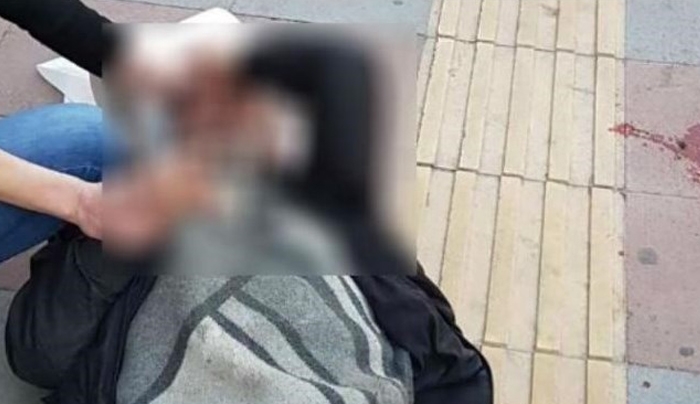 Πάτρα: Μαθητής λυκείου άνοιξε το κεφάλι συμμαθητή του μέσα στο σχολείο