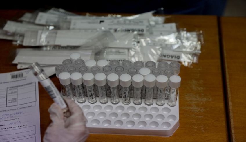 Άνδρας στην Ξάνθη ξανά θετικός στον ιό 4 μήνες μετά - Γιατί ανησυχούν οι επιστήμονες